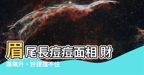 眉尾長痘痘面相|臉上痘痘影響運勢 8部位對應不同危機